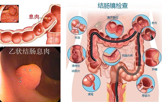 泉州治疗肠胃炎的费用是多少